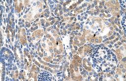 Antibody used in IHC on Human kidney.