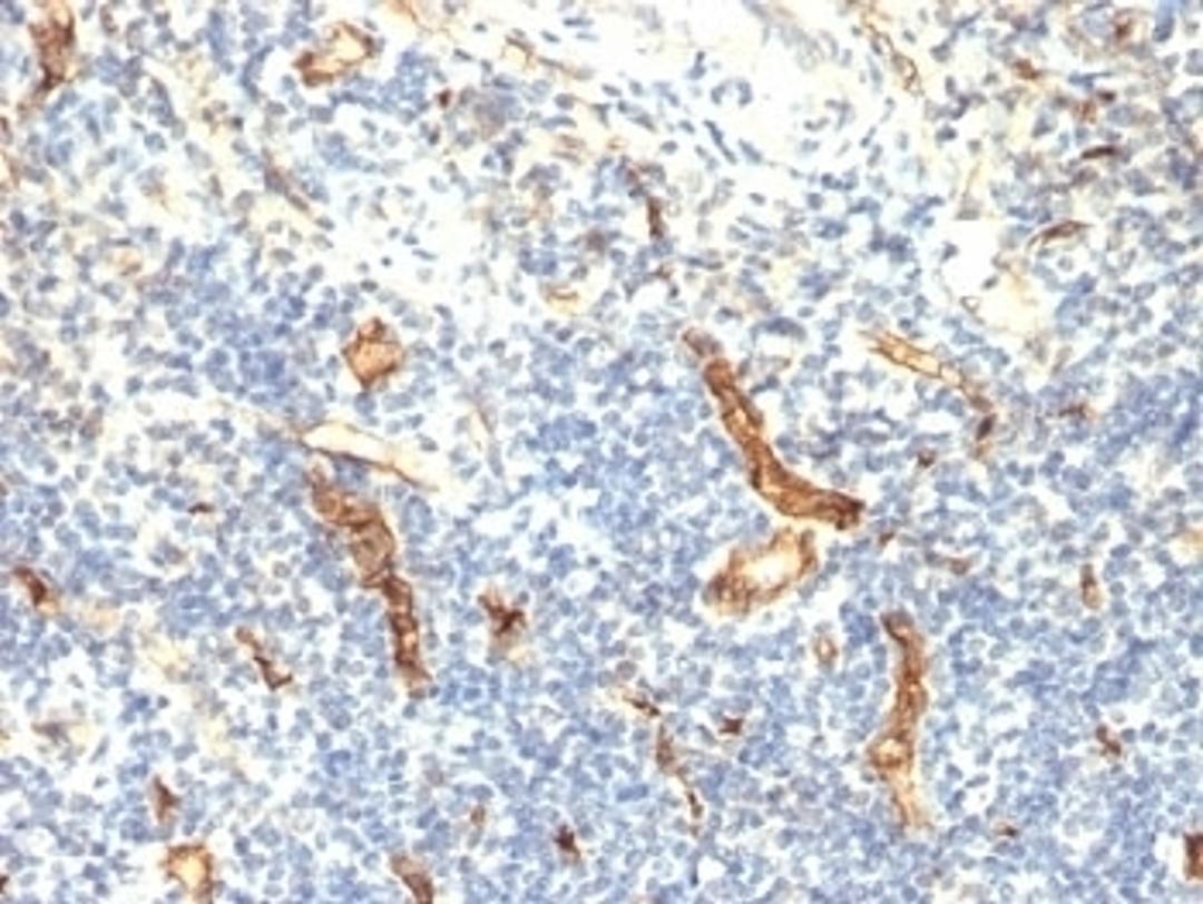 Formalin-fixed, paraffin-embedded human tonsil stained with anti-CD34 antibody (HPCA1/1171)