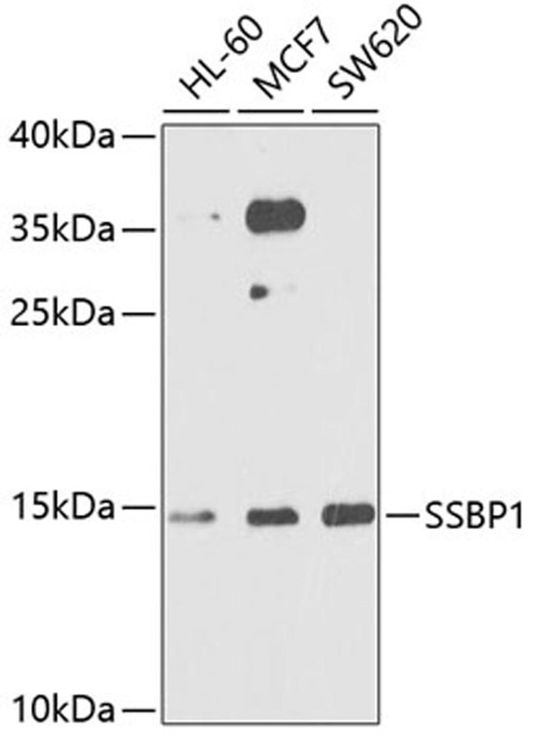 Western blot - SSBP1 antibody (A6987)