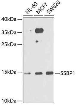 Western blot - SSBP1 antibody (A6987)