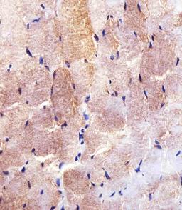 Immunohistochemical analysis of paraffin-embedded H. skeletal muscle section using HK2 (Hexokinase II) Antibody . Antibody was diluted at 1:100 dilution. A undiluted biotinylated goat polyvalent antibody was used as the secondary, followed by DAB staining