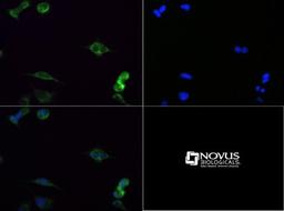 Immunocytochemistry/Immunofluorescence: SDHA Antibody [NBP1-71688] - SDHA antibody was tested at 1:100 in HeLa cells with FITC (green). Nuclei (Blue) were counterstained with Dapi (blue).