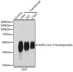 Immunofluorescence - SARS-CoV-2 Nucleoprotein pAb(A18797)