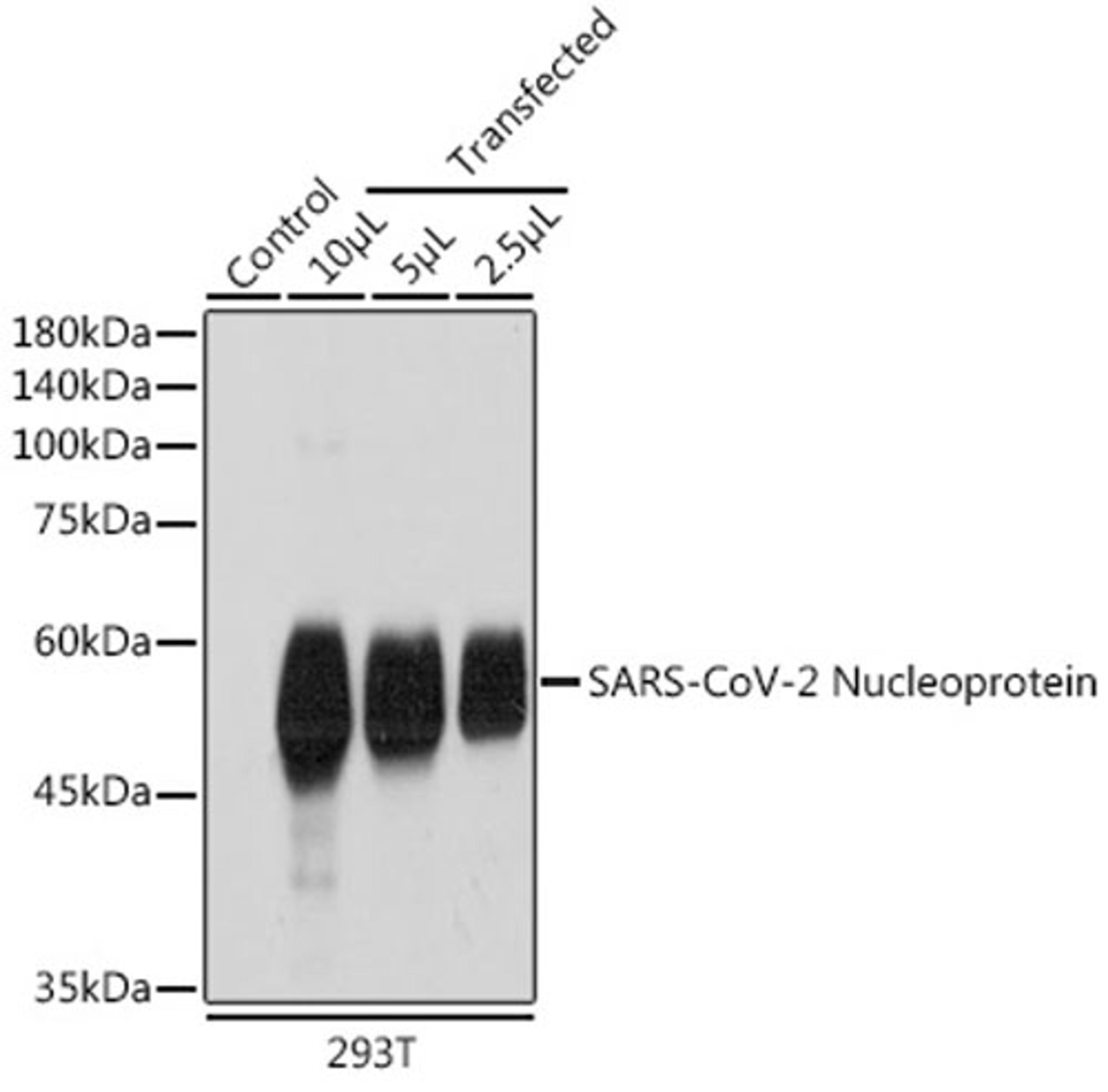 Immunofluorescence - SARS-CoV-2 Nucleoprotein pAb(A18797)