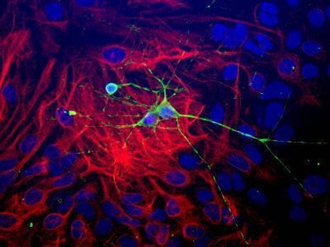 Immunocytochemistry/Immunofluorescence: beta-III Tubulin Antibody [NB100-1612] - Dissociated cell culture of a neonatal mouse brain showing beta-III Tubulin (green staining) of neurons. These cultures were counter-stained with a rabbit anti-GFAP antibody (red staining) to identify astrocytes, and with DAPI (blue staining) to localize nuclei.