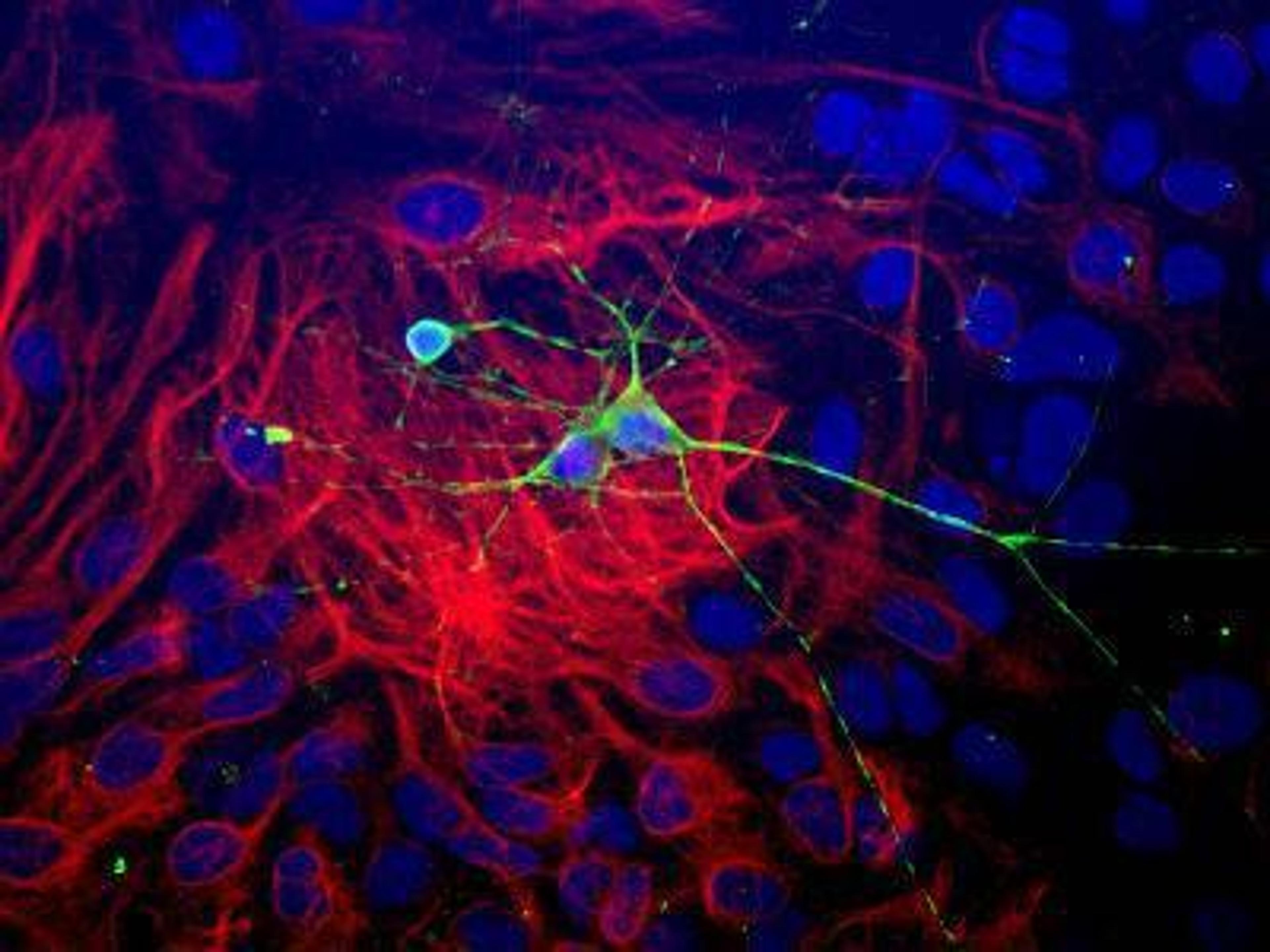 Immunocytochemistry/Immunofluorescence: beta-III Tubulin Antibody [NB100-1612] - Dissociated cell culture of a neonatal mouse brain showing beta-III Tubulin (green staining) of neurons. These cultures were counter-stained with a rabbit anti-GFAP antibody (red staining) to identify astrocytes, and with DAPI (blue staining) to localize nuclei.