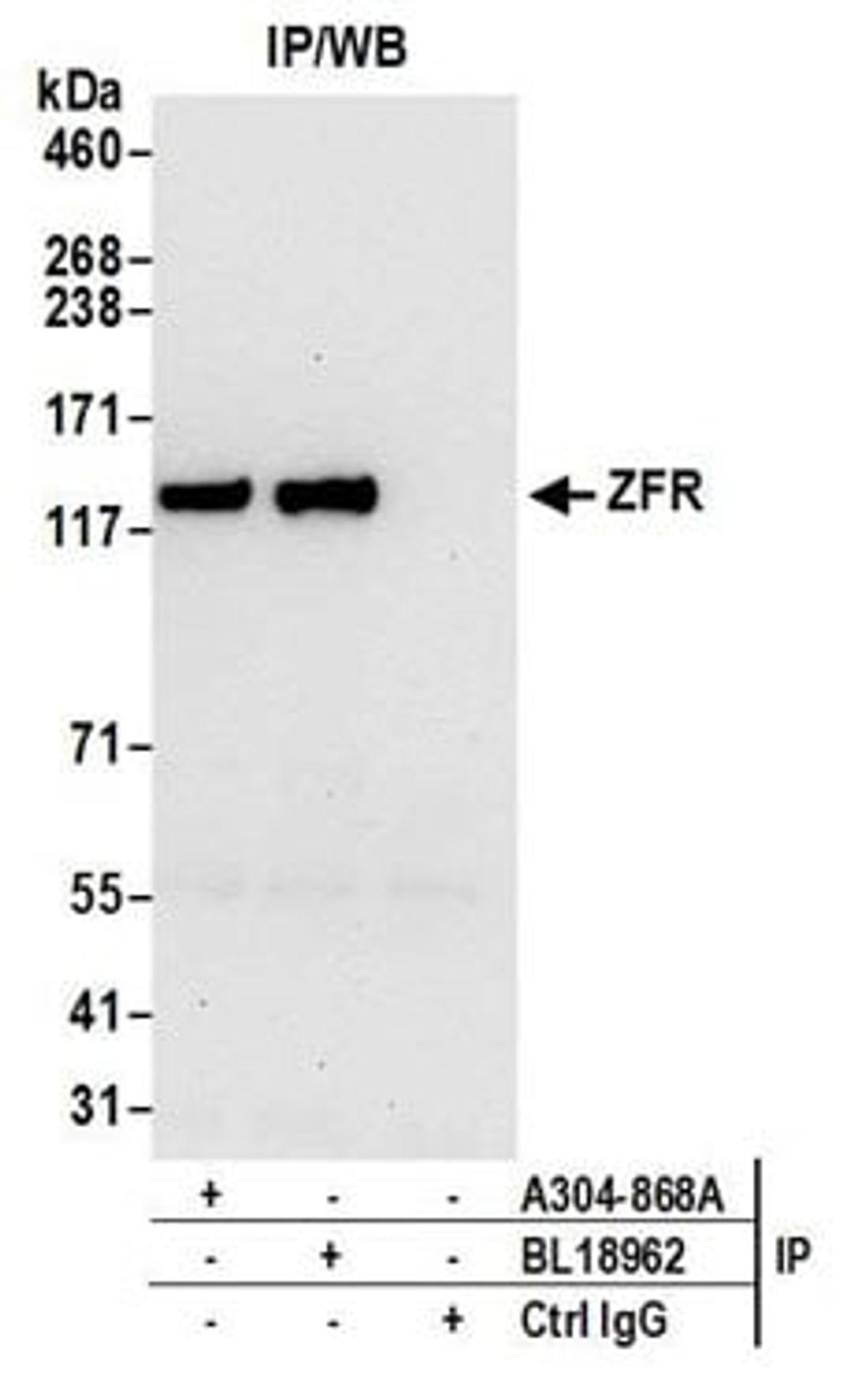 Detection of human ZFR by western blot of immunoprecipitates.