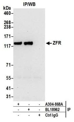 Detection of human ZFR by western blot of immunoprecipitates.