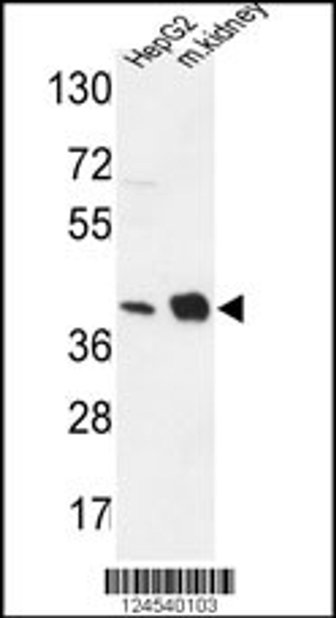 Western blot analysis in HepG2 cell line and mouse kidney tissue lysates (35ug/lane).