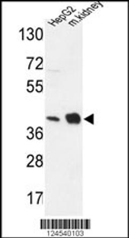 Western blot analysis in HepG2 cell line and mouse kidney tissue lysates (35ug/lane).