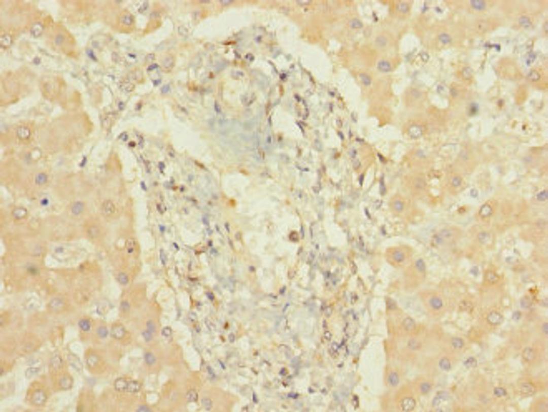 Immunohistochemistry of paraffin-embedded human liver tissue using CSB-PA006444LA01HU at dilution of 1:100