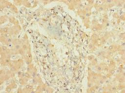 Immunohistochemistry of paraffin-embedded human liver tissue using CSB-PA006444LA01HU at dilution of 1:100