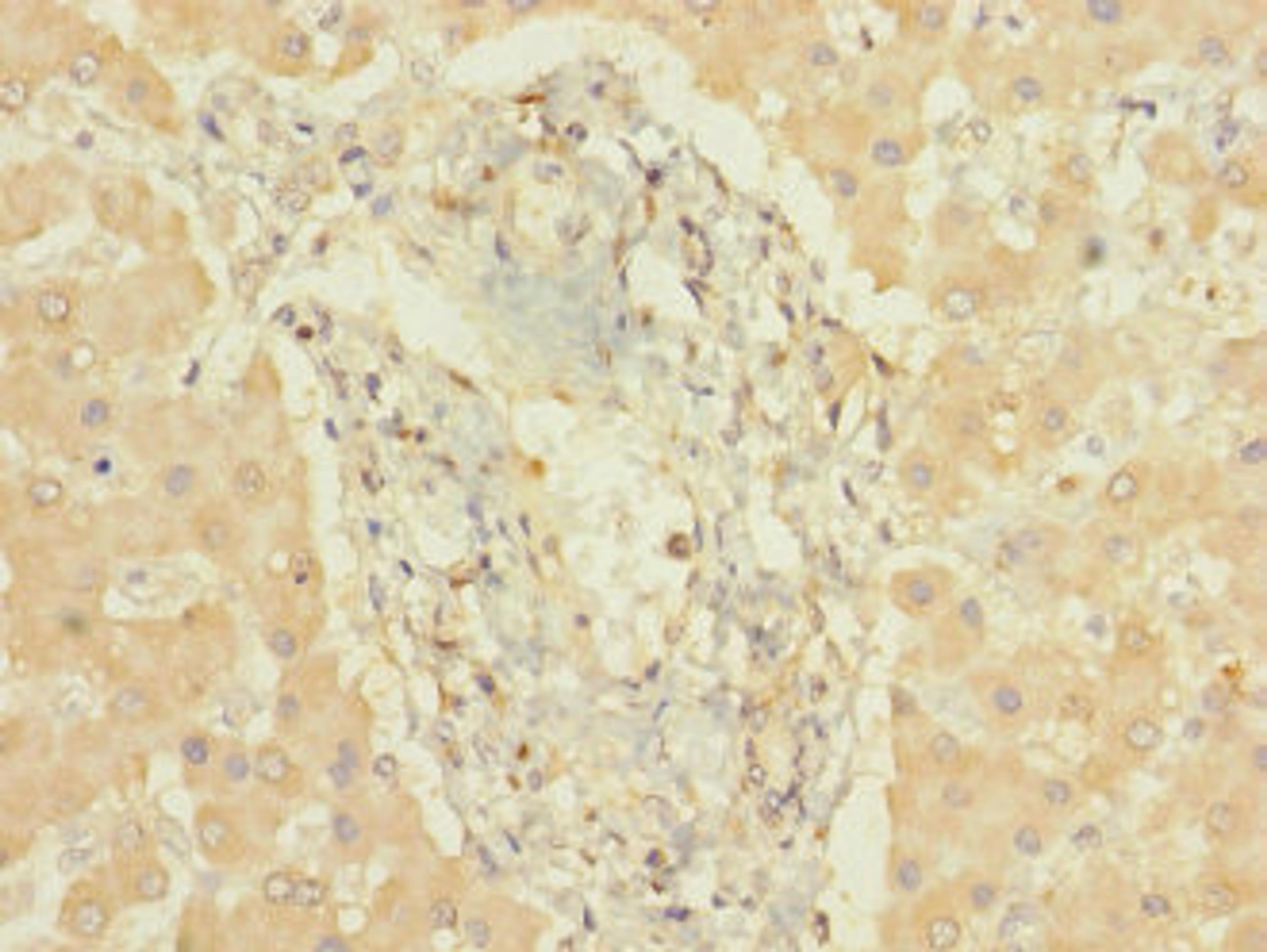 Immunohistochemistry of paraffin-embedded human liver tissue using CSB-PA006444LA01HU at dilution of 1:100