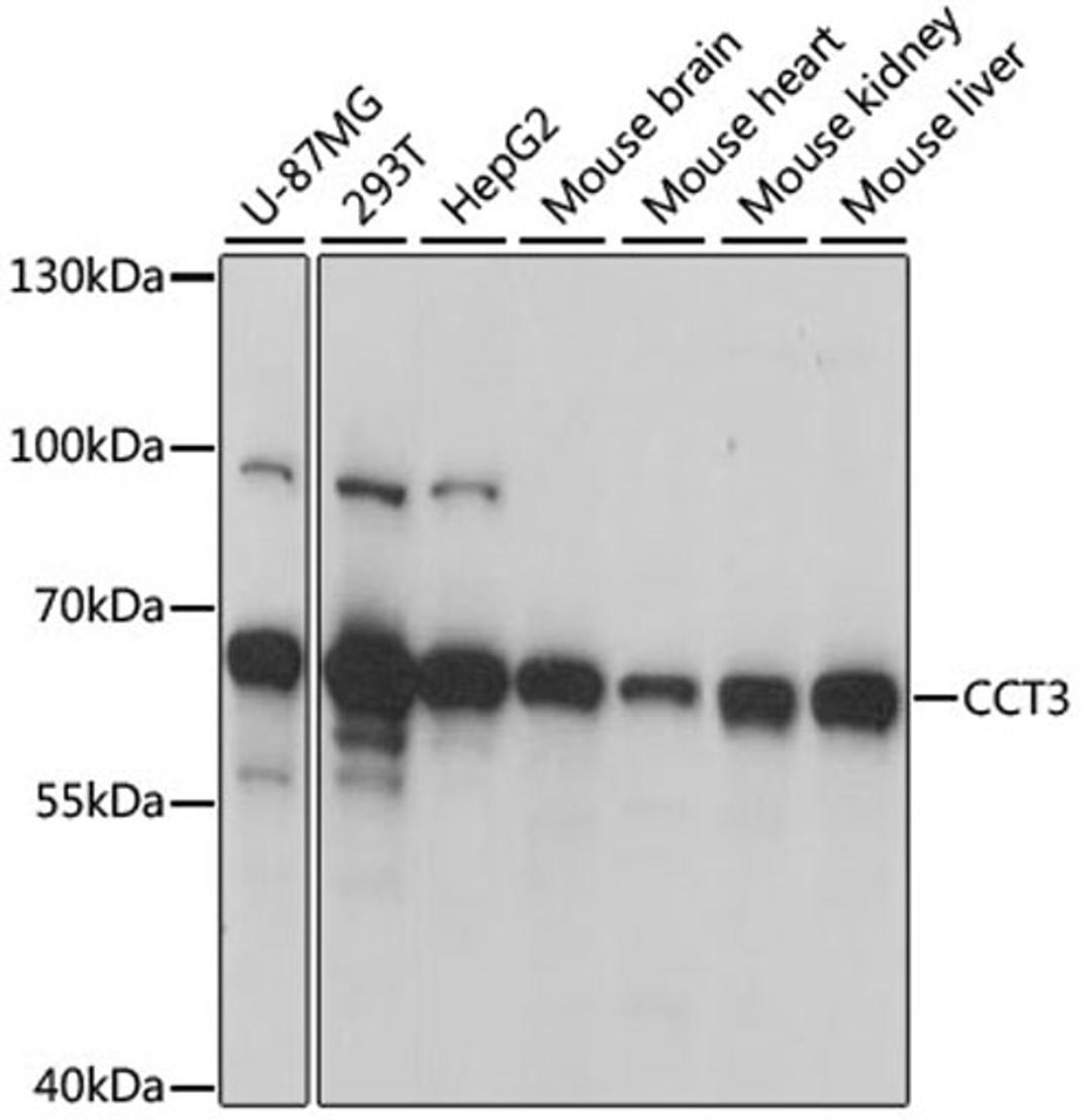 Western blot - CCT3 antibody (A6547)