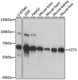 Western blot - CCT3 antibody (A6547)