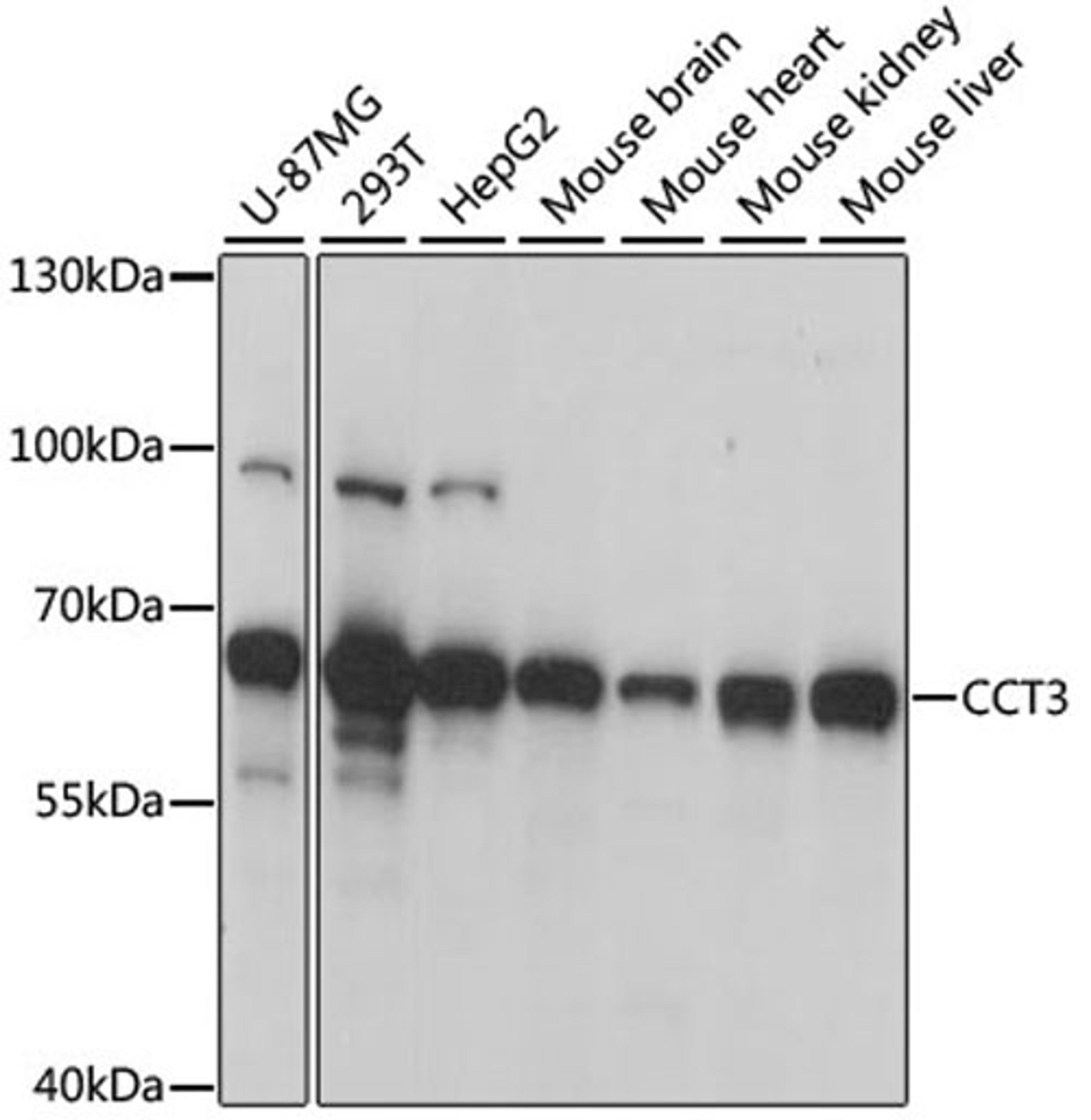 Western blot - CCT3 antibody (A6547)