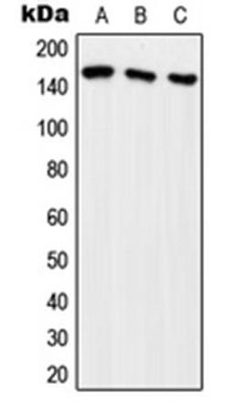 Western blot analysis of HeLa (Lane 1), HEK293T (Lane 2), SP2/0 (Lane 3) whole cell lysates using ARHGEF10 antibody