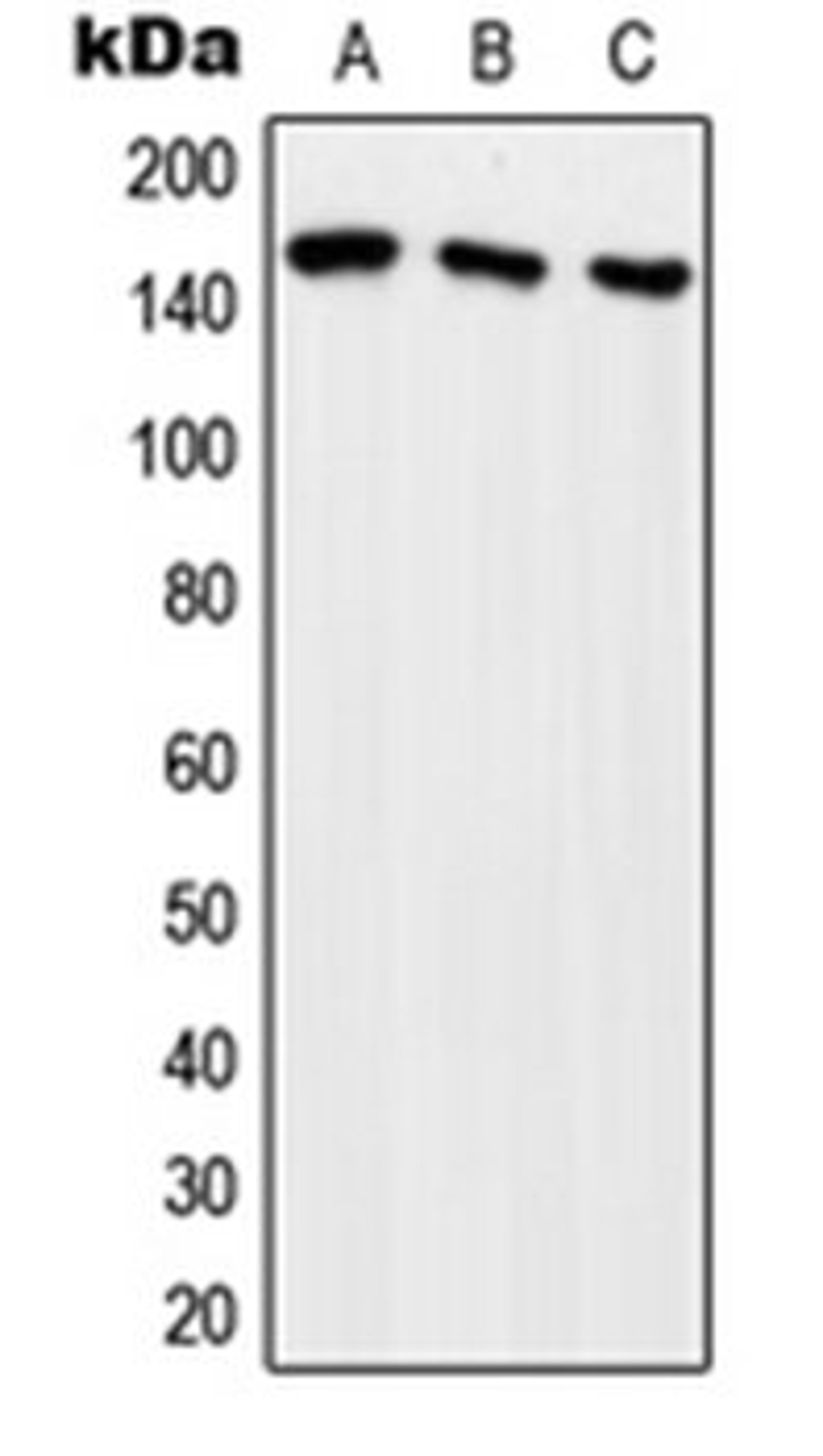 Western blot analysis of HeLa (Lane 1), HEK293T (Lane 2), SP2/0 (Lane 3) whole cell lysates using ARHGEF10 antibody