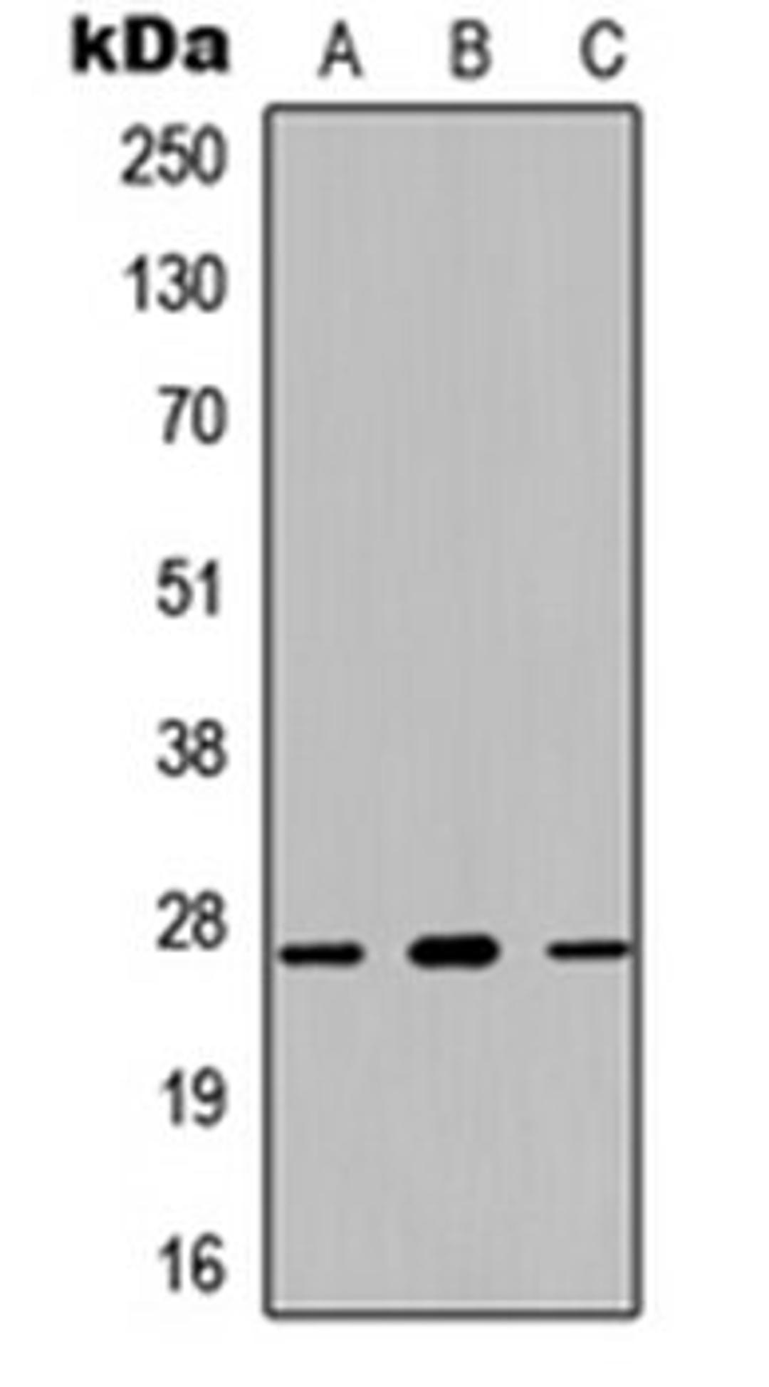 Western blot analysis of HEK293T (Lane 1), NS-1 (Lane 2), PC12 (Lane 3) whole cell lysates using Kallikrein 7 antibody