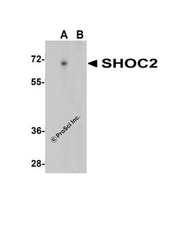 Western blot analysis of SHOC2 in Jurkat cell lysate with SHOC2 antibody at 1 μg/mL in (A) the absence and (B) the presence of blocking peptide