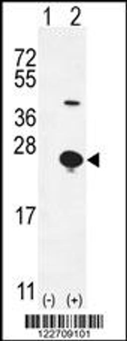 Western blot analysis of EPGN using rabbit polyclonal EPGN Antibody using 293 cell lysates (2 ug/lane) either nontransfected (Lane 1) or transiently transfected (Lane 2) with the EPGN gene.