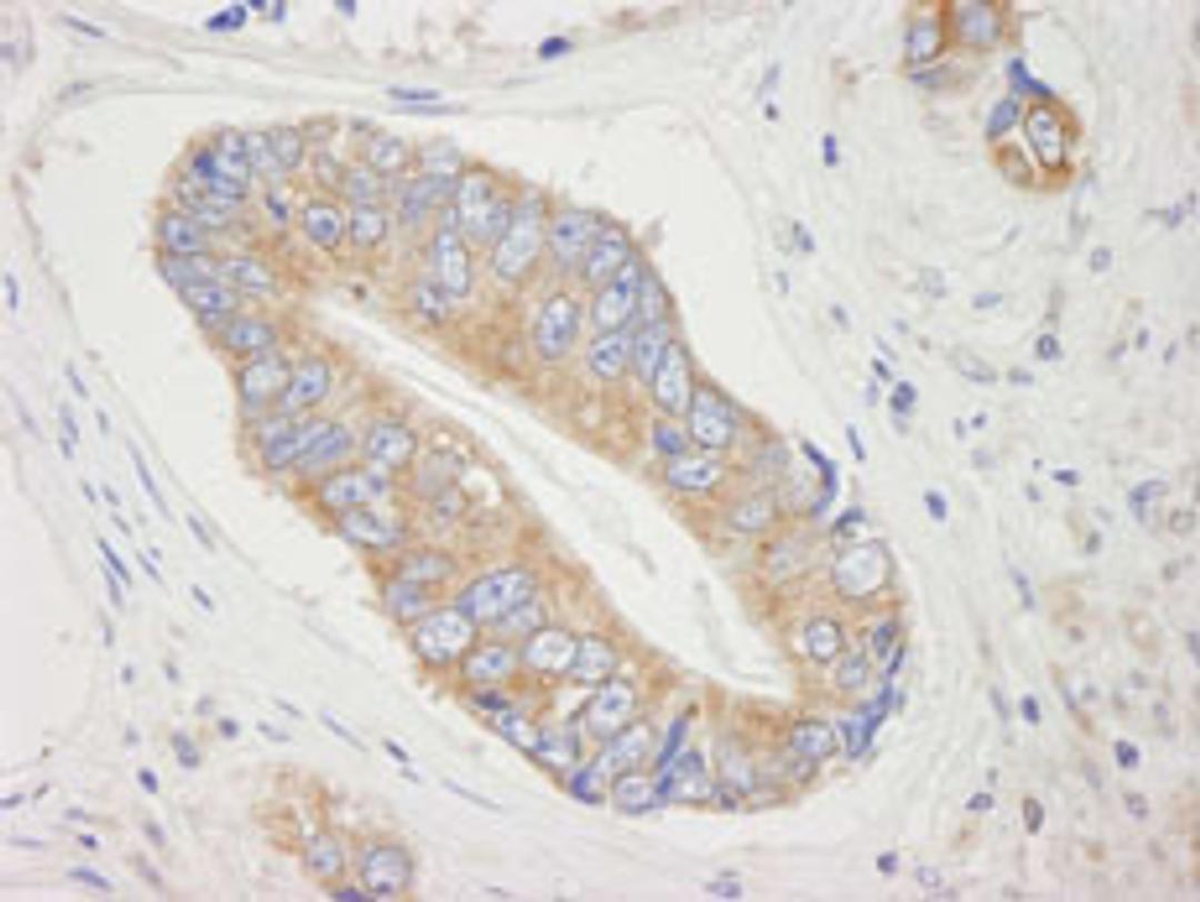 Detection of human 4E-T/elF4E-T by immunohistochemistry.