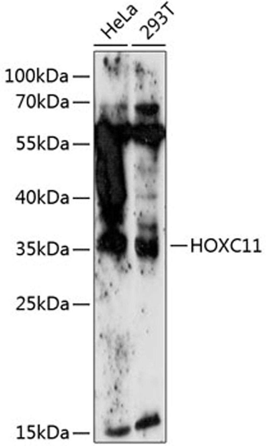 Western blot - HOXC11 antibody (A14742)