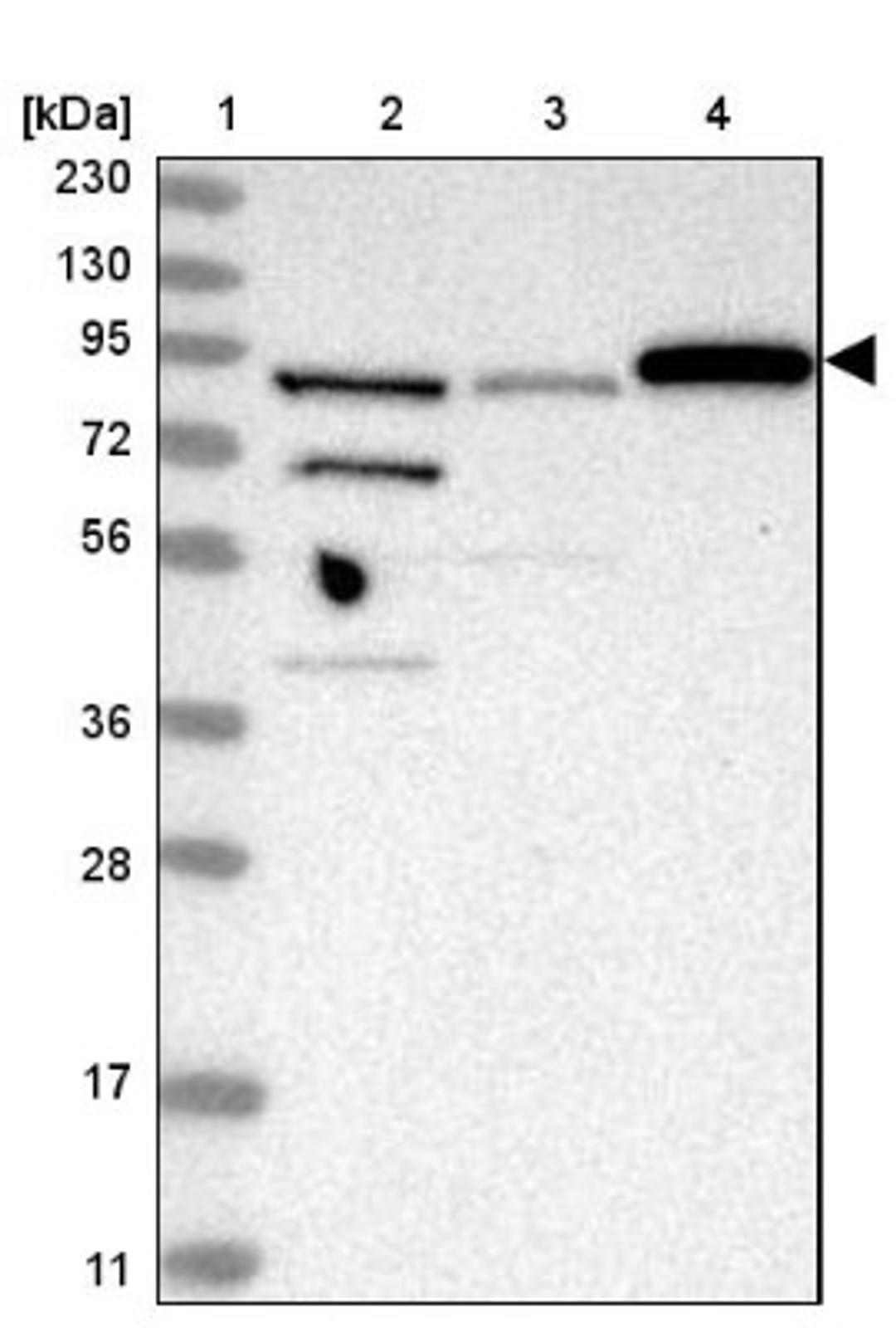 Western Blot: SPATA20 Antibody [NBP1-82146] - Lane 1: Marker [kDa] 230, 130, 95, 72, 56, 36, 28, 17, 11<br/>Lane 2: Human cell line RT-4<br/>Lane 3: Human cell line U-251MG sp<br/>Lane 4: Human plasma (IgG/HSA depleted)