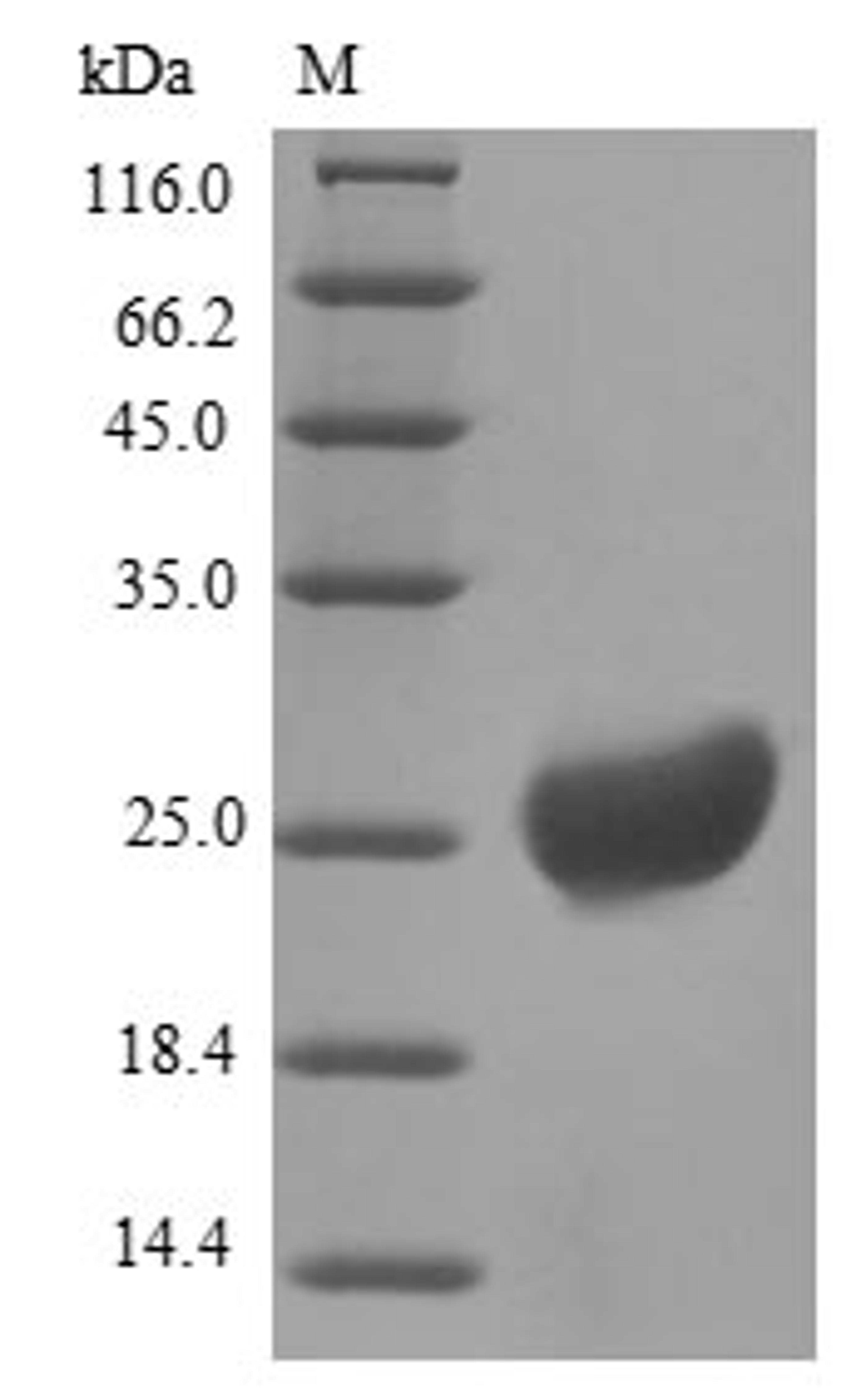 (Tris-Glycine gel) Discontinuous SDS-PAGE (reduced) with 5% enrichment gel and 15% separation gel.