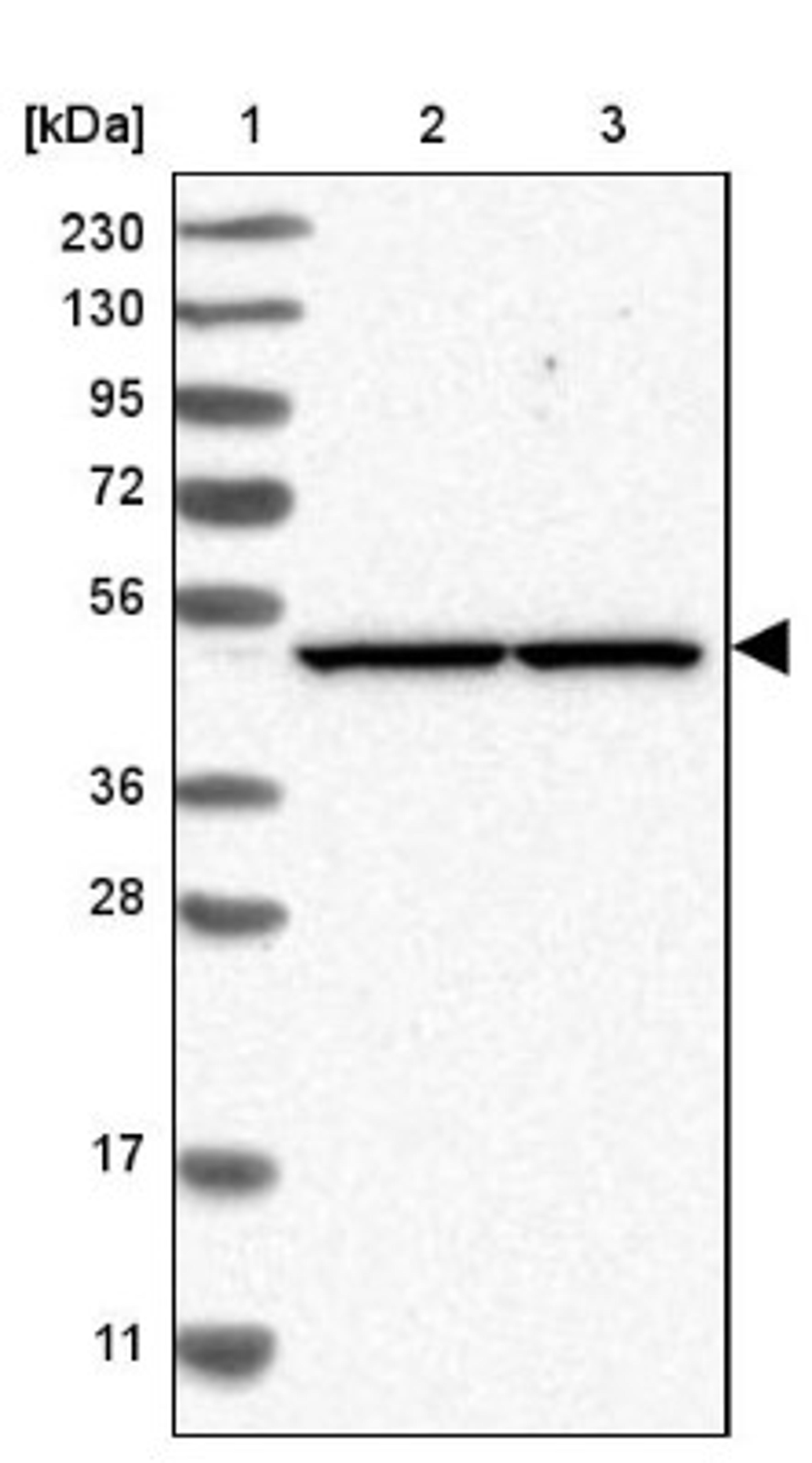 Western Blot: eIF3e Antibody [NBP1-84869] - Lane 1: Marker [kDa] 230, 130, 95, 72, 56, 36, 28, 17, 11<br/>Lane 2: Human cell line RT-4<br/>Lane 3: Human cell line U-251MG sp