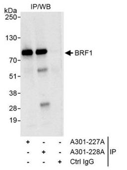 Detection of human BRF1 by western blot of immunoprecipitation.