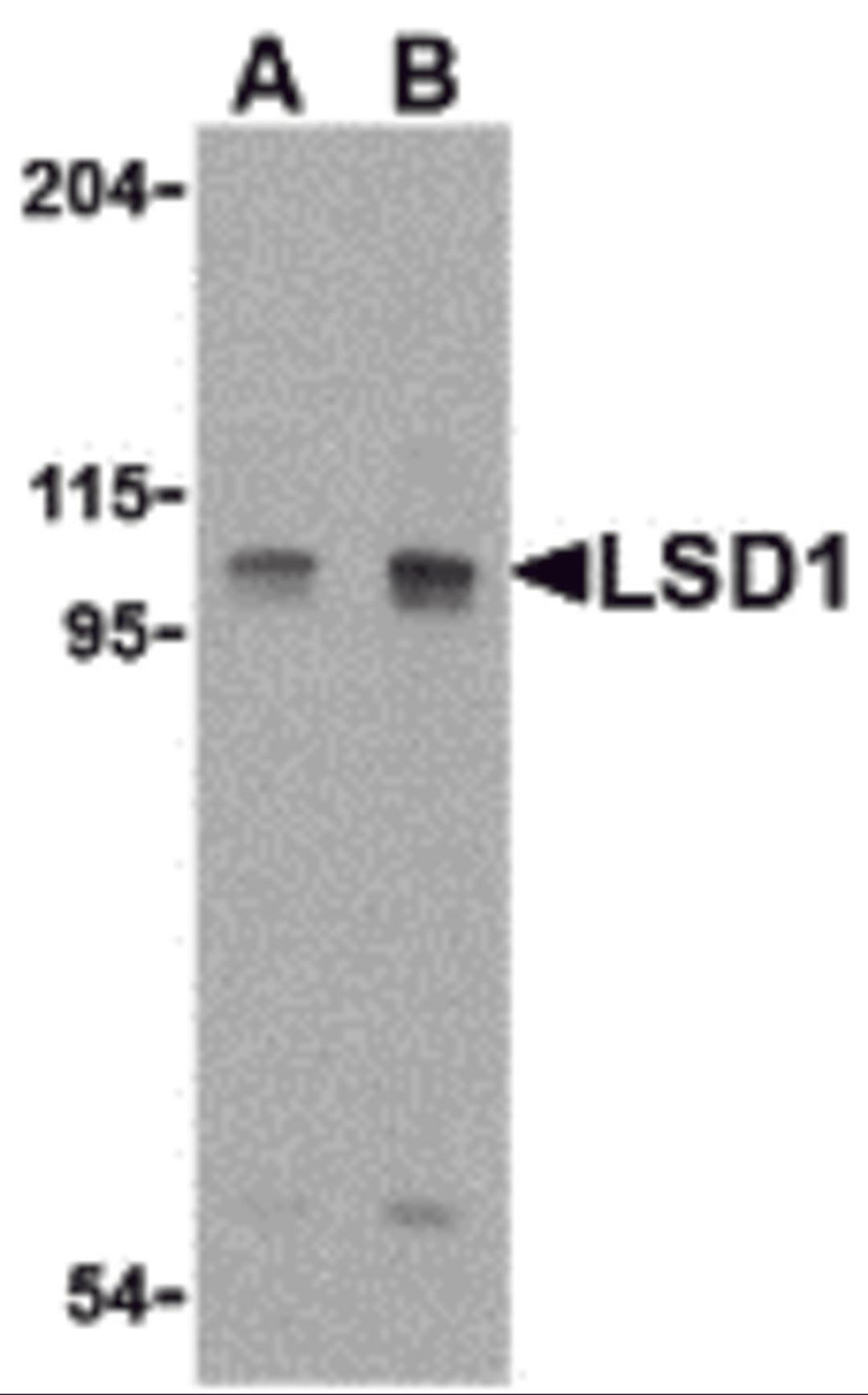 Western blot analysis of LSD1 in P815 cell lysate with LSD1 antibody at (A) 1 and (B) 2 &#956;g/mL.