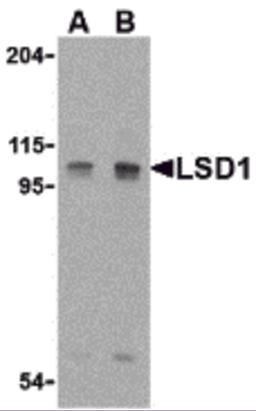 Western blot analysis of LSD1 in P815 cell lysate with LSD1 antibody at (A) 1 and (B) 2 μg/mL.