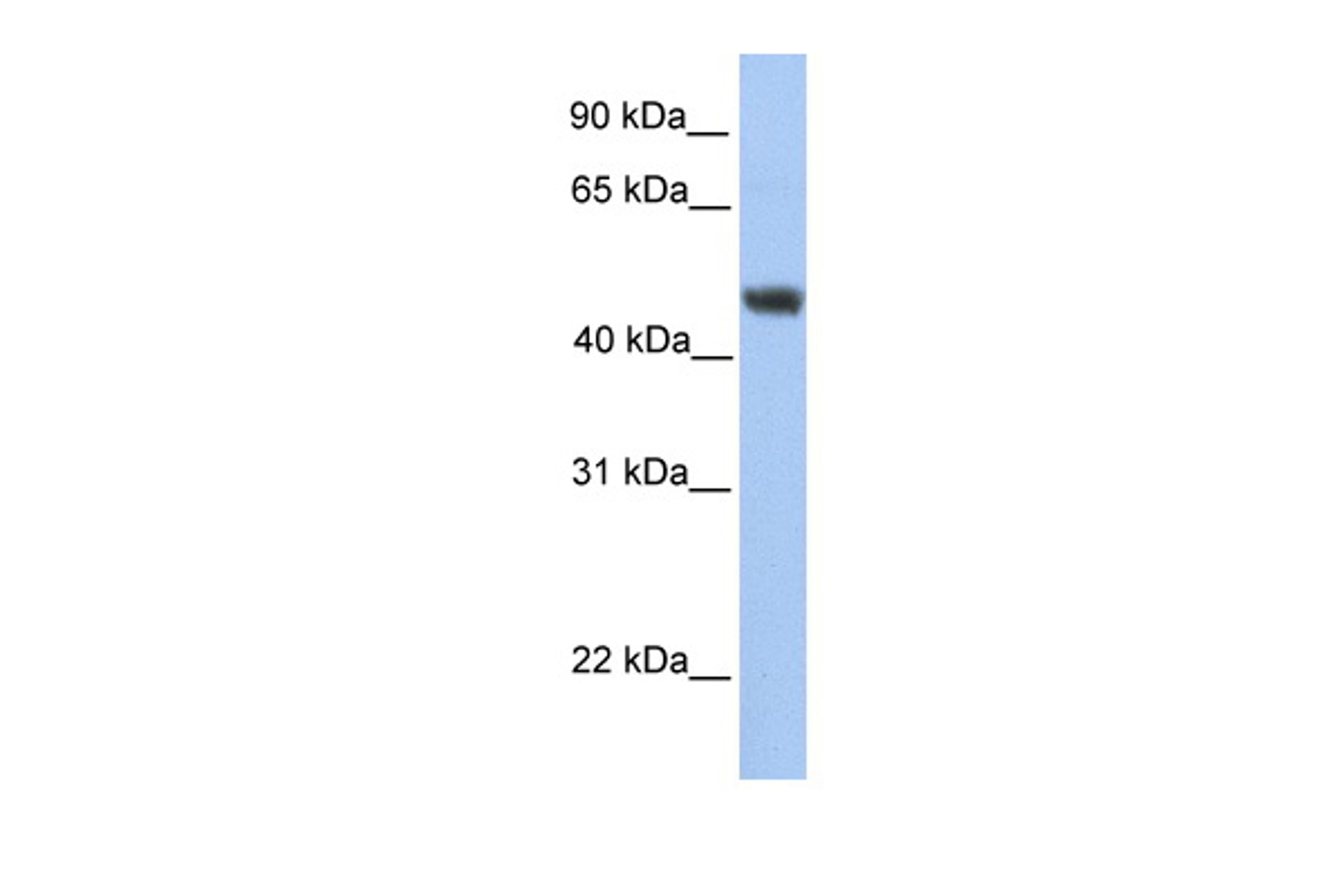 Antibody used in WB on Human HepG2 at 0.2-1 ug/ml.