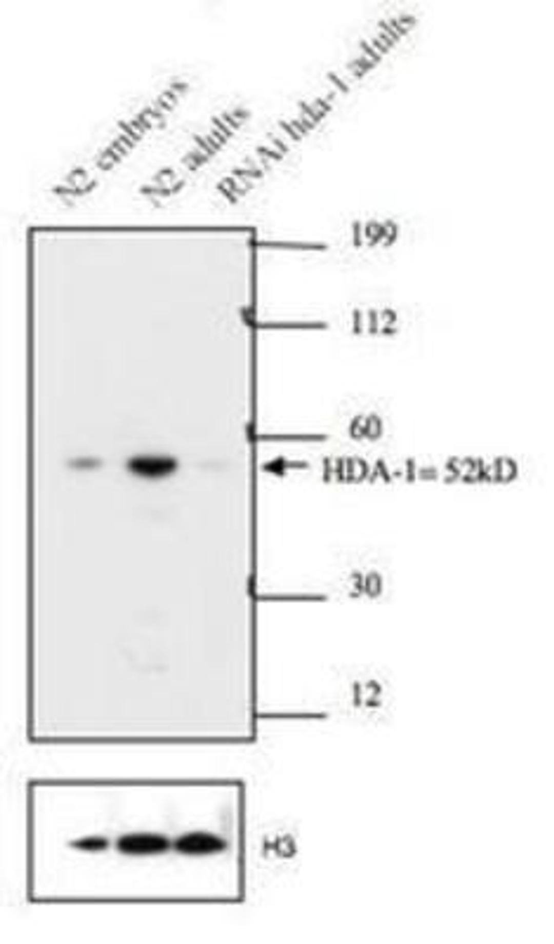 Western Blot: hda-1 Antibody [38660002] - This image is specific to animal number Q2326 Dilution: 1:3000