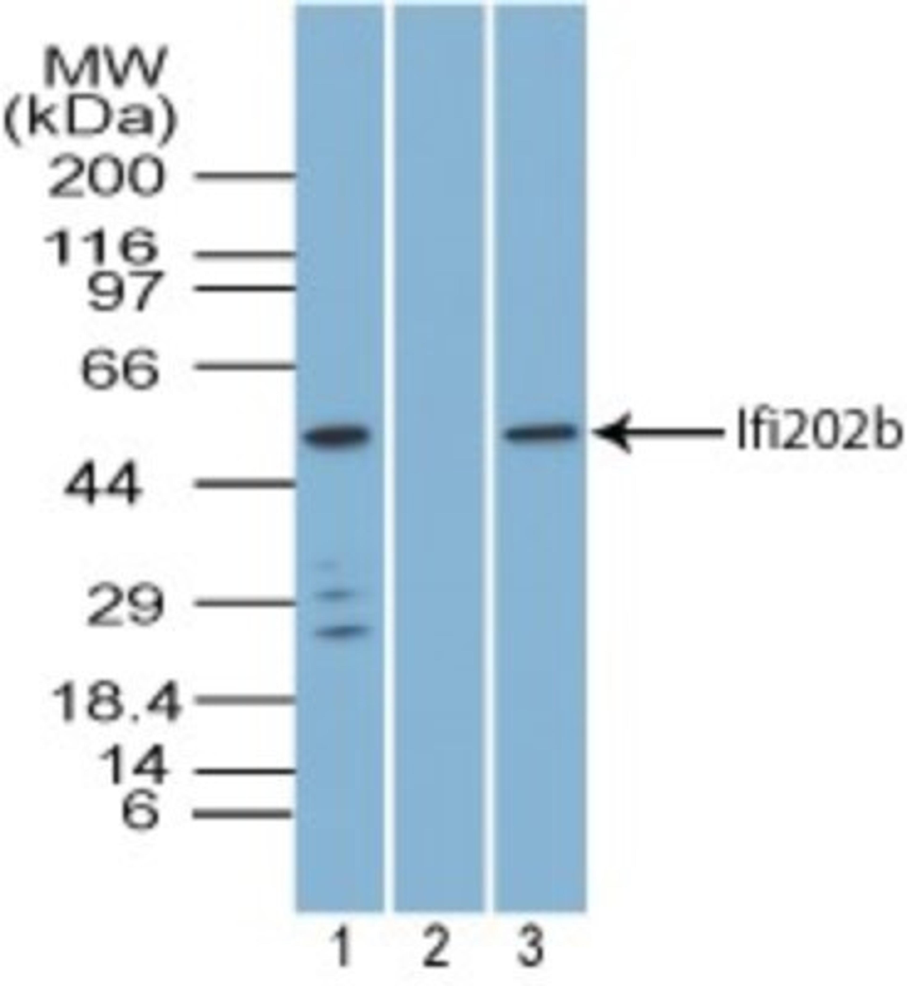 Western Blot: IFI16 Antibody [NBP2-27066] - Analysis of Ifi202b in mouse spleen tissue lysate in the 1) absence and 2) presence of immunizing peptide, and 3) NIH 3T3 cell lysate using this antibody. Goat anti-rabbit Ig HRP secondary antibody and PicoTect ECL substrate solution were used for this test.