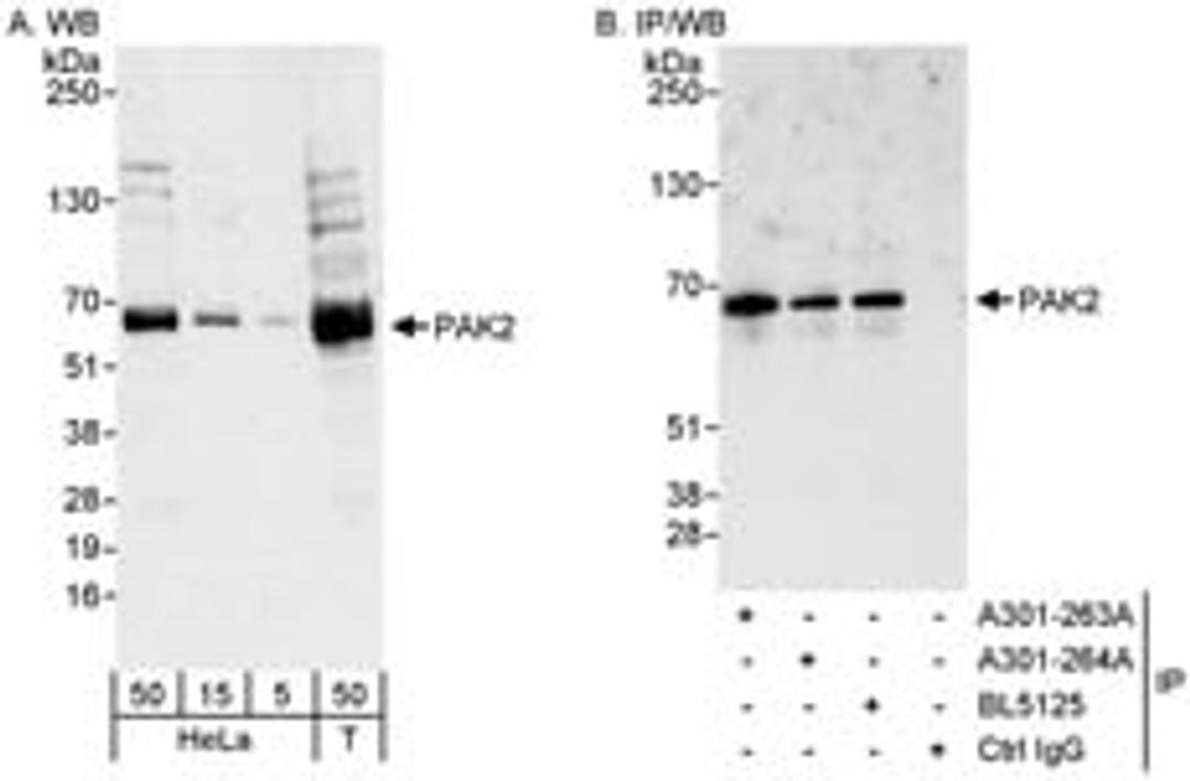 Detection of human PAK2 by western blot and immunoprecipitation.