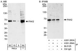 Detection of human PAK2 by western blot and immunoprecipitation.