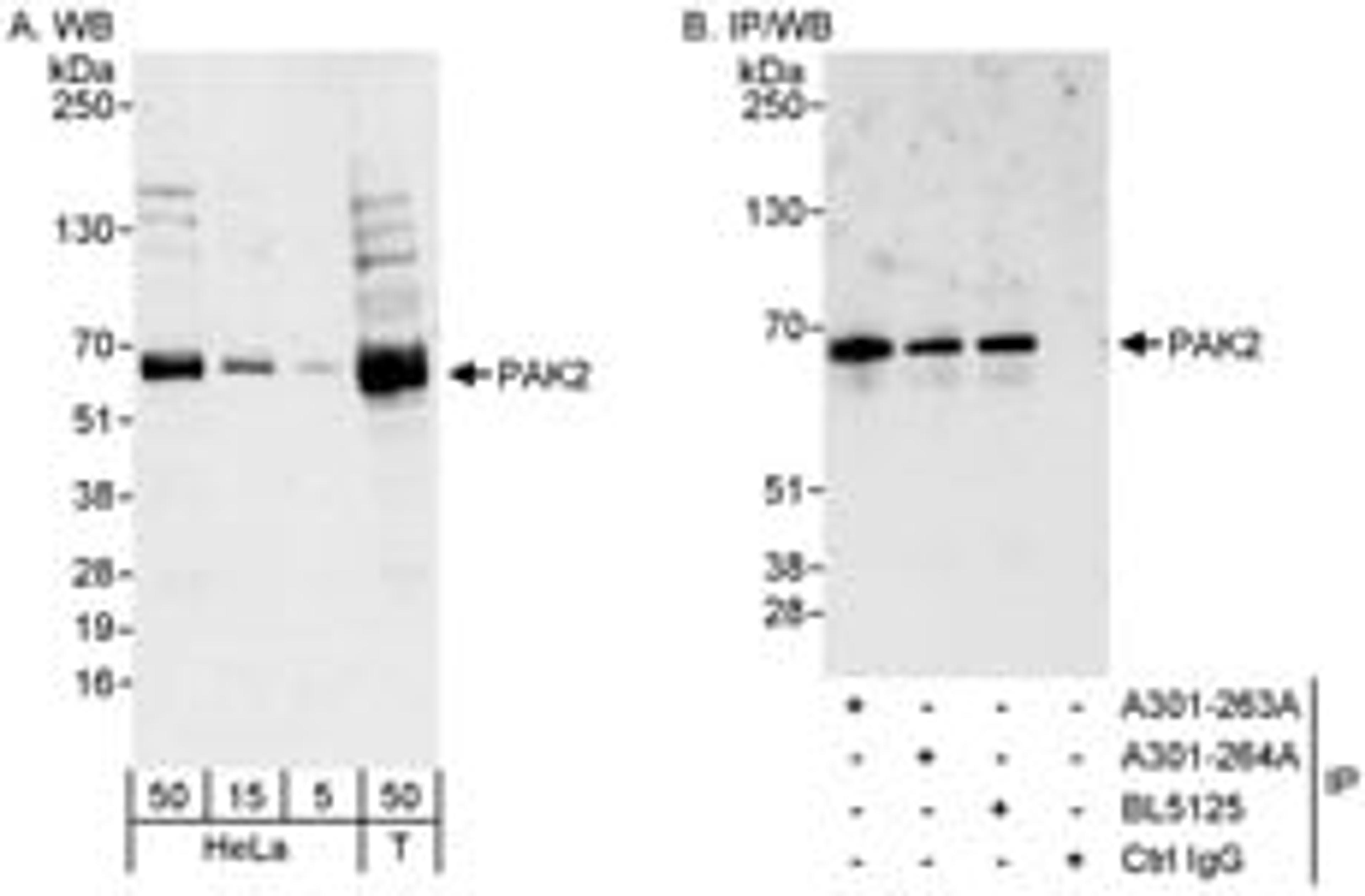 Detection of human PAK2 by western blot and immunoprecipitation.