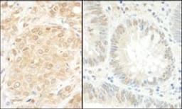 Detection of human MEK1 by immunohistochemistry.