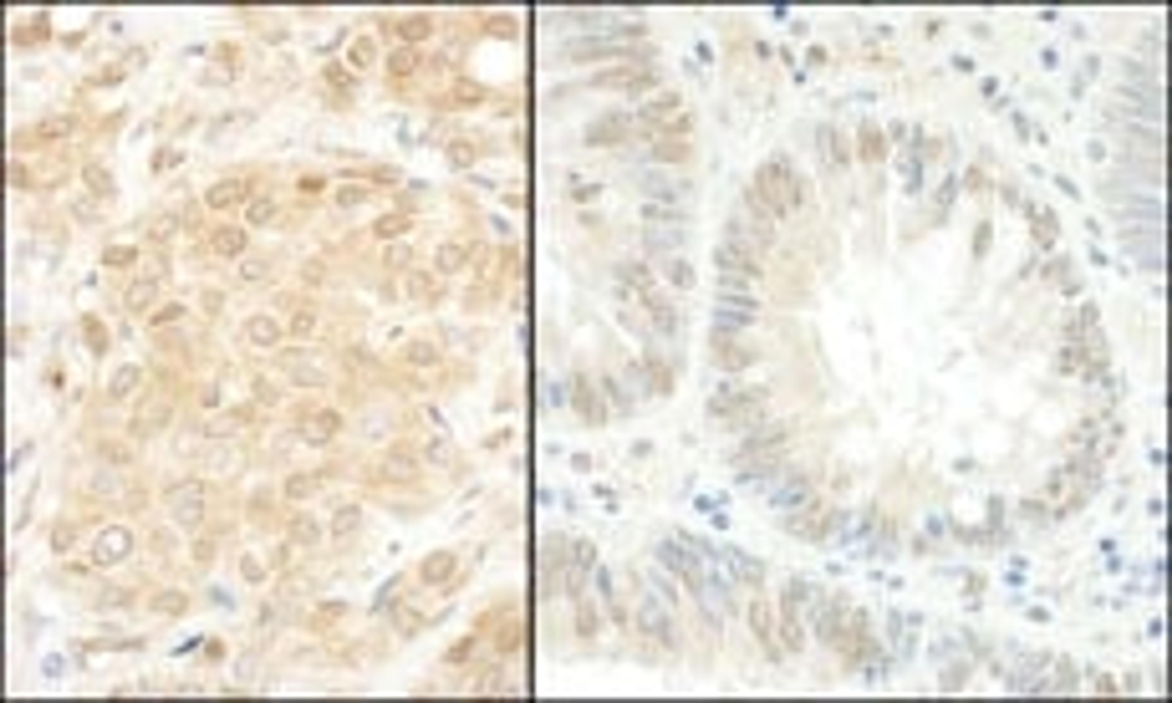 Detection of human MEK1 by immunohistochemistry.