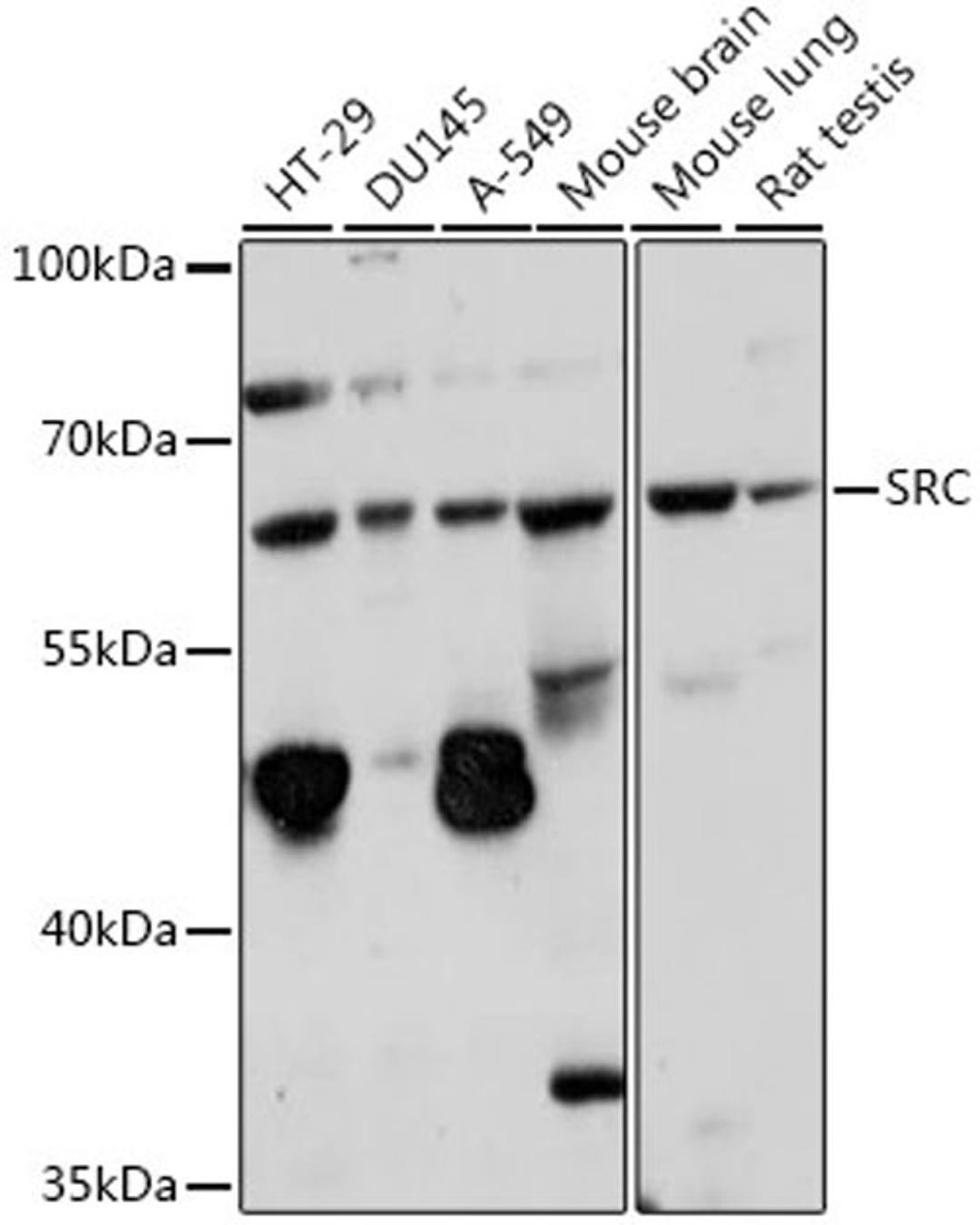 Western blot - SRC antibody (A0324)