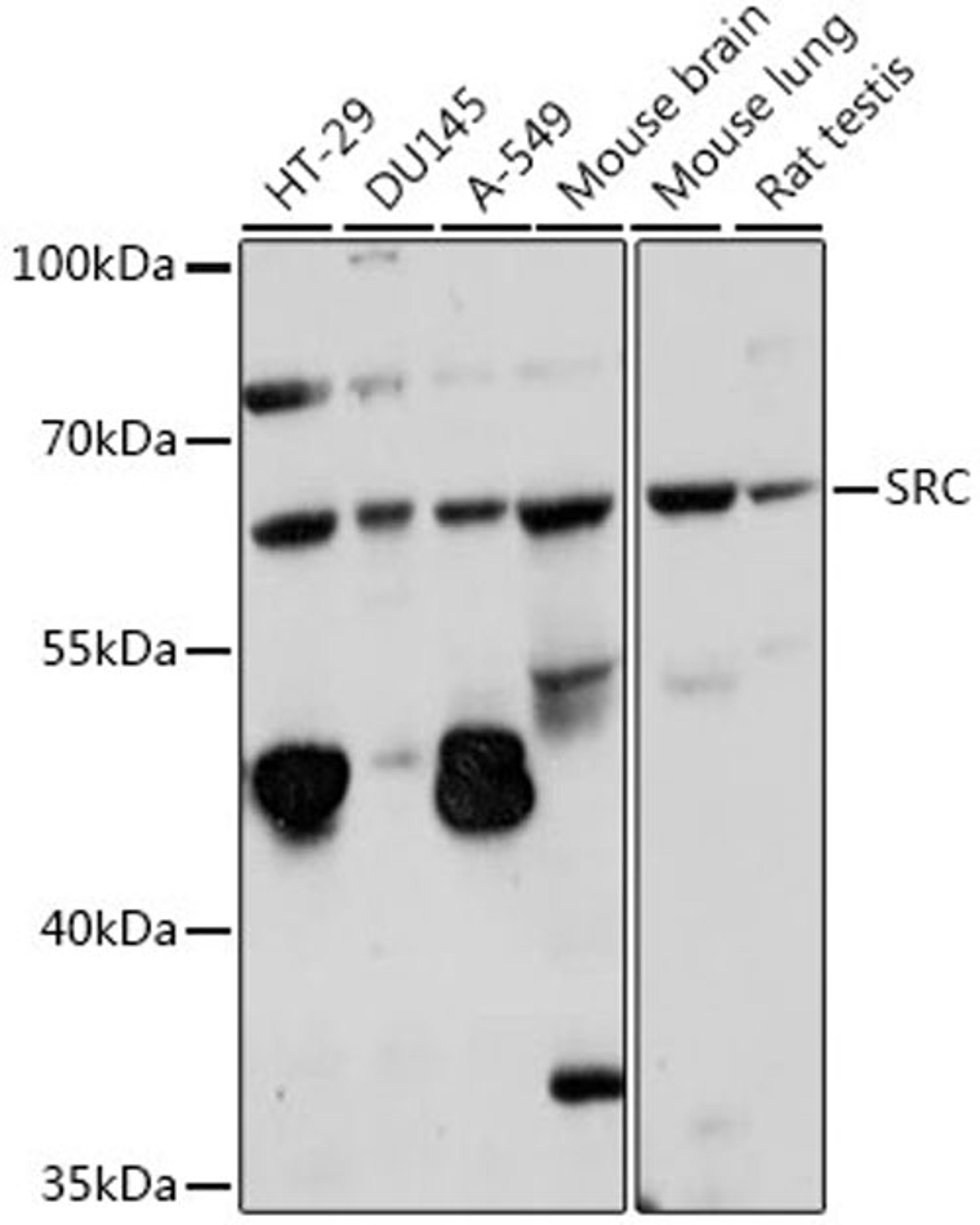 Western blot - SRC antibody (A0324)