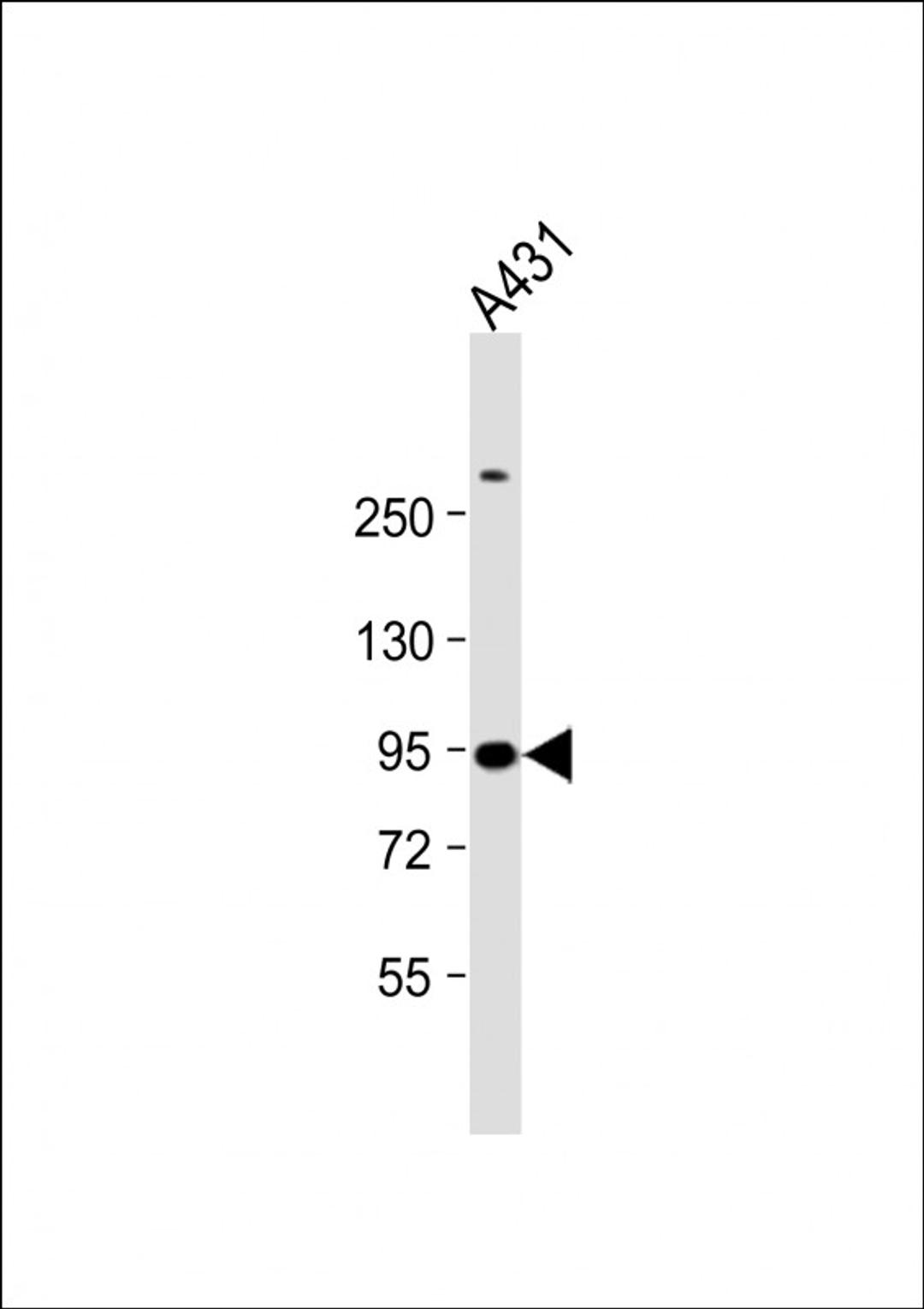 Western Blot at 1:1000 dilution + A431 whole cell lysate Lysates/proteins at 20 ug per lane.