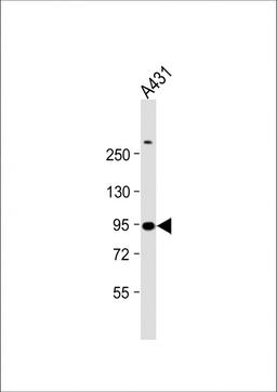 Western Blot at 1:1000 dilution + A431 whole cell lysate Lysates/proteins at 20 ug per lane.