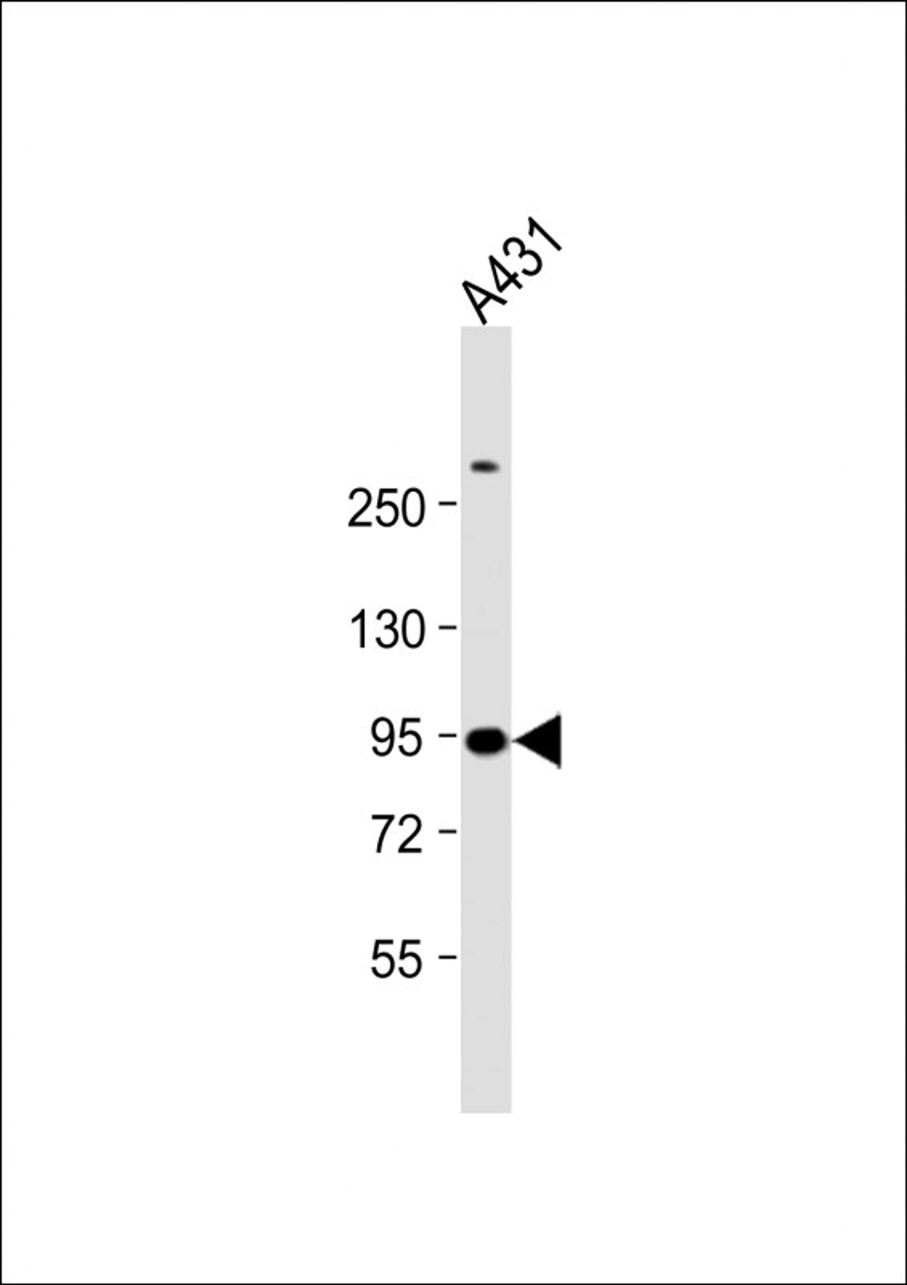 Western Blot at 1:1000 dilution + A431 whole cell lysate Lysates/proteins at 20 ug per lane.