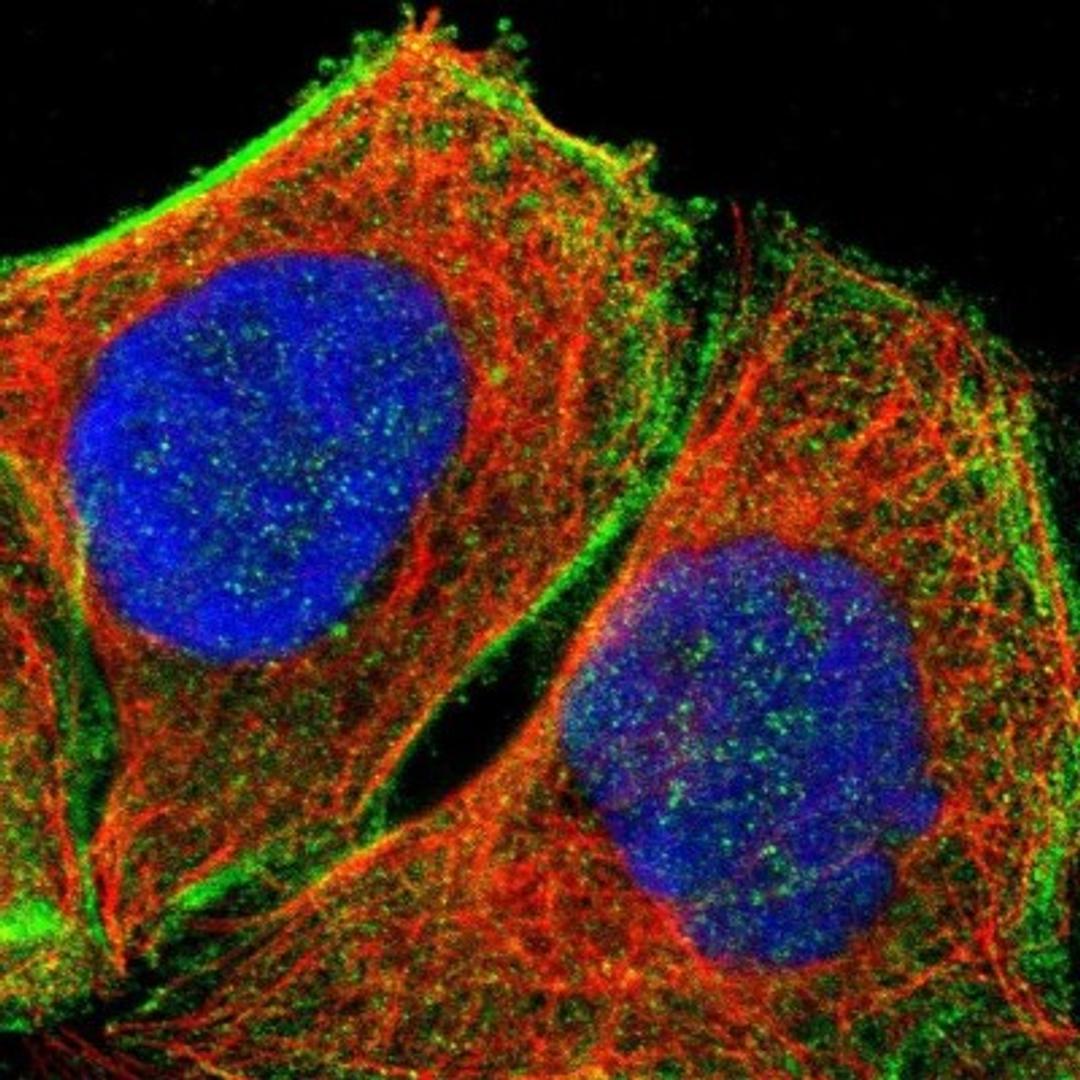 Immunocytochemistry/Immunofluorescence: DHRSX Antibody [NBP1-85219] - Human cell line A-431 shows positivity in cytoplasm & cytoskeleton (actin filaments).