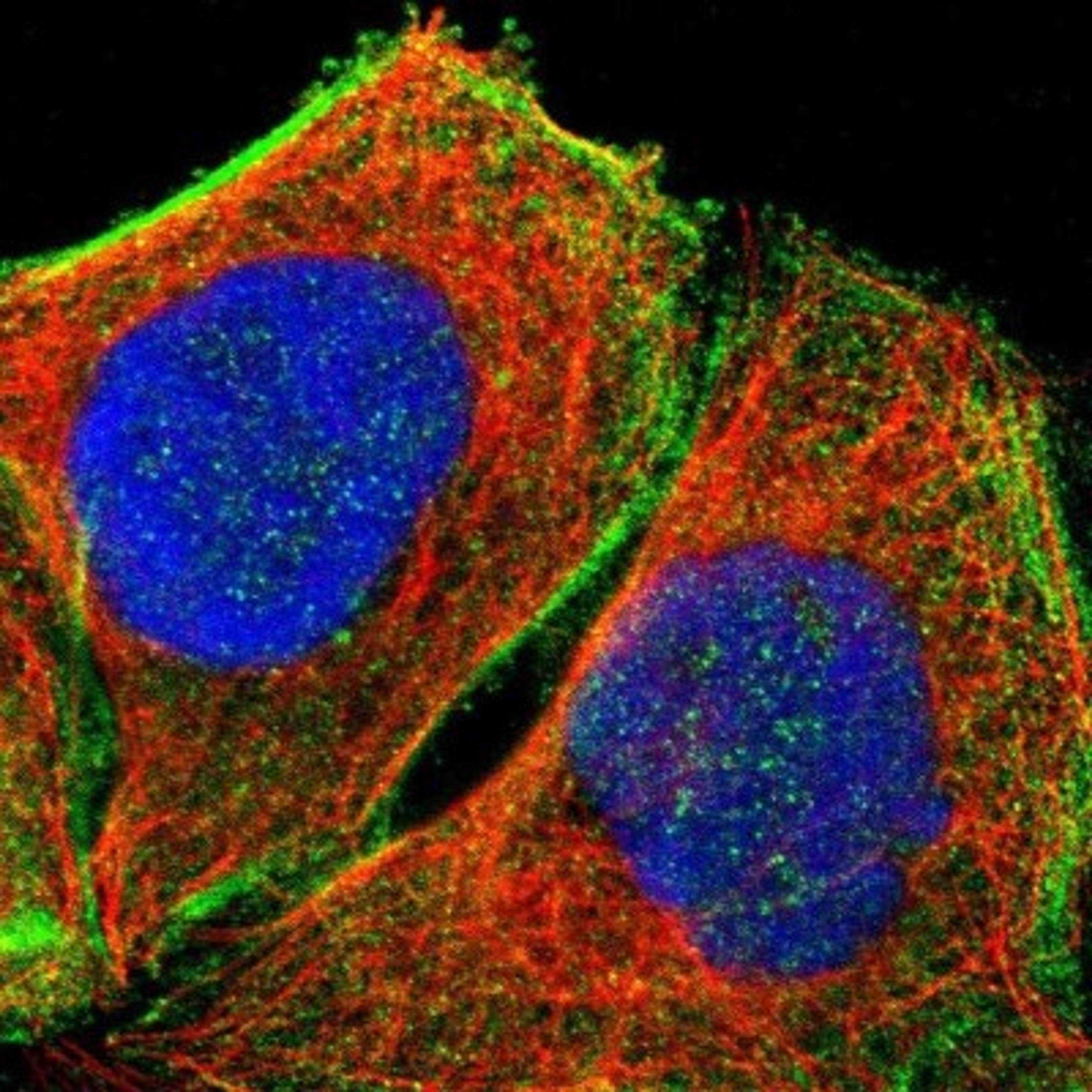 Immunocytochemistry/Immunofluorescence: DHRSX Antibody [NBP1-85219] - Human cell line A-431 shows positivity in cytoplasm & cytoskeleton (actin filaments).