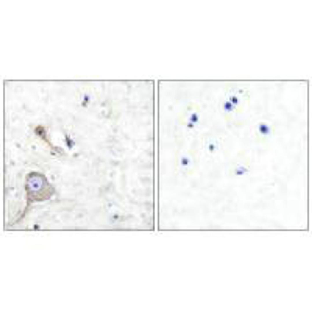 Immunohistochemical analysis of paraffin-embedded human brain tissue using S100 A1 antibody.