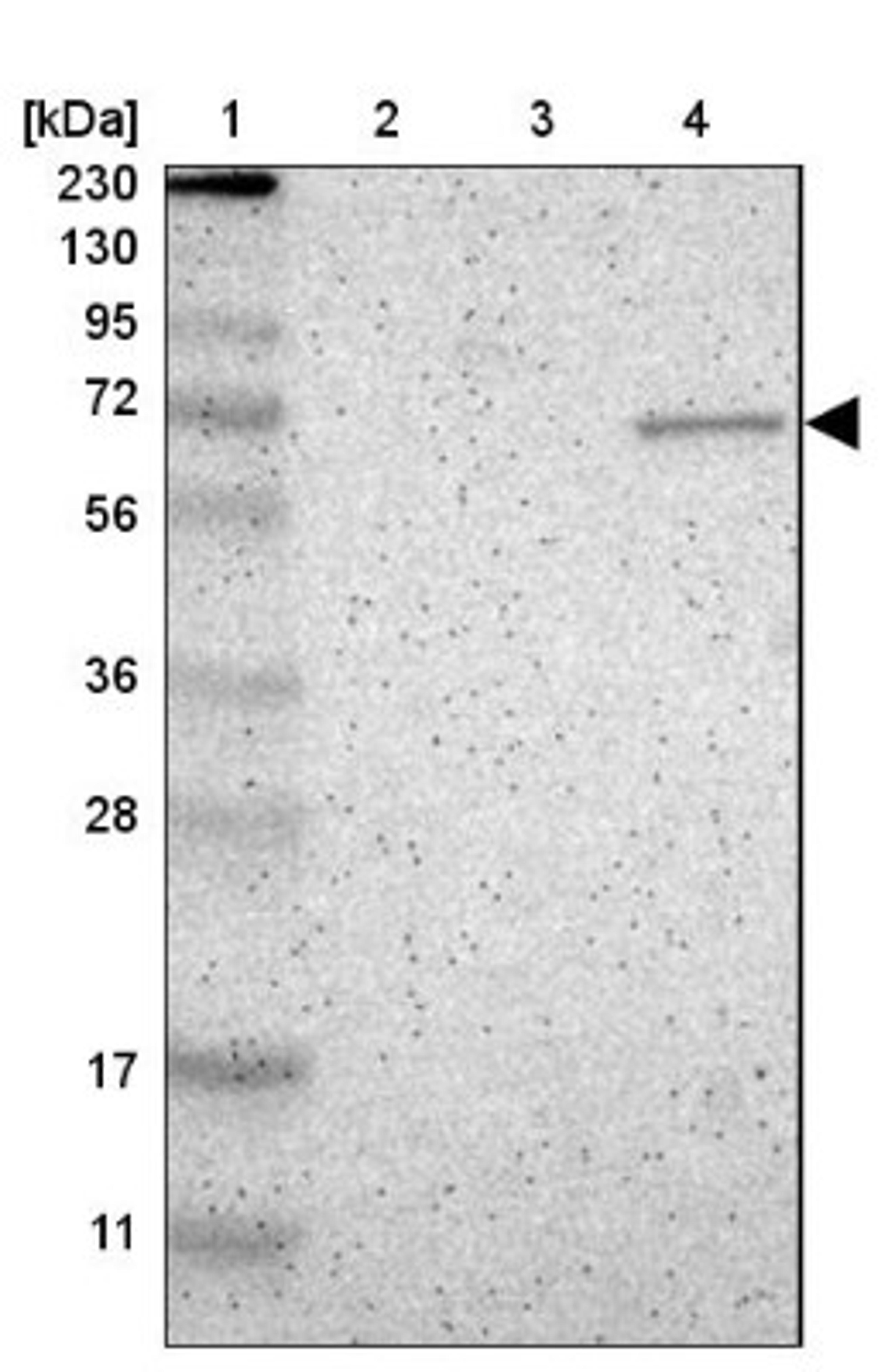 Western Blot: ZNF37A Antibody [NBP1-81345] - Lane 1: Marker [kDa] 230, 130, 95, 72, 56, 36, 28, 17, 11<br/>Lane 2: Human cell line RT-4<br/>Lane 3: Human cell line U-251MG sp<br/>Lane 4: Human plasma (IgG/HSA depleted)